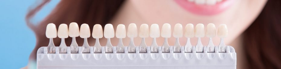 10 facts everyone should know about teeth whitening