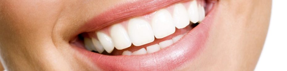 how to prevent your teeth from yellowing after undergoing teeth whitening